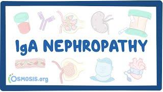 IgA nephropathy - causes, symptoms, diagnosis, treatment, pathology