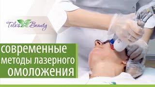 Лазерное омоложение лица.  Уникальный аппарат для лазерного омоложения лица. Telo's Beauty