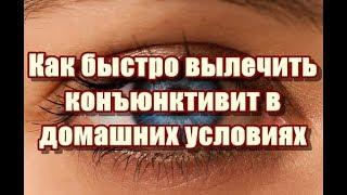 Как быстро вылечить конъюнктивит в домашних условиях