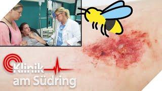 Insektenstich EXTREM  Not-OP wegen entzündeten Gewebes | Klinik am Südring | SAT.1