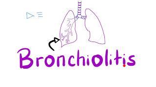 Acute Bronchiolitis, Bronchiolitis Obliterans-Organizing Pneumonia (BOOP) | Pulmonology