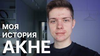 Лечу акне | Начал пить Роаккутан