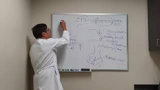 Craniopharyngioma in Neuro ophthalmology