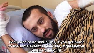 AzeriWarCrimes: Chemical weapons in Karabakh