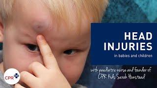 Head injuries in babies and children