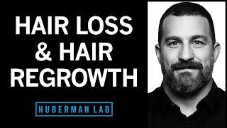 The Science of Healthy Hair, Hair Loss and How to Regrow Hair | Huberman Lab Podcast