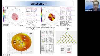 Sydney Eye Hospital Webinar July 2020
