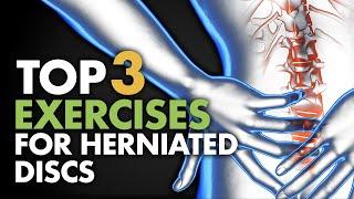 Top 3 Exercises For Herniated Discs