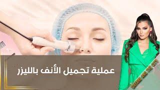 عملية تجميل الأنف بالليزر