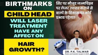 Birthmark on my Child Head! Will Laser Treatment have any affect on hair Growth? Dr. PK Talwar