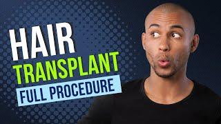 Hair Transplant Full Procedure (No Cuts) | Performed by Dr. Arun Panda | Bodyskulpt Aesthetics