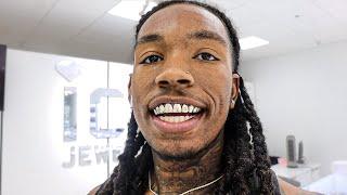 I GOT MY DIAMOND GRILLZ FITTED BEFORE THEY PUT THE DIAMONDS IN @Richindacut