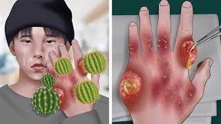 [ASMR Animation] Remove cactus spines from Gdragon's hand | WOW Brain Satisfyingvideo