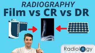 Film vs CR vs DR (for Radiologic Technologists)