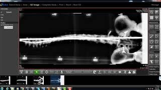 Spine DR Stitching Software for Physician Office, Clinic