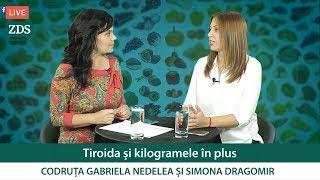 Codruța Nedelea: Tiroida și kilogramele în plus