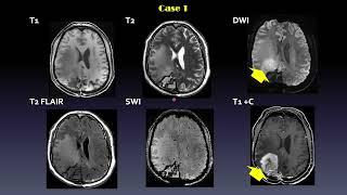 ISMRM MR Academy: 7T ASL Perfusion MRI - Methods and Applications