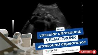 Celiac Trunk ultrasound appearance: vascular ultrasound learning