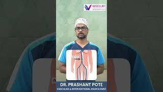 DVT क्या होता है? जानिए Deep Vein Thrombosis के लक्षण और इलाज #DVT#DeepVeinThrombosis#BloodClot