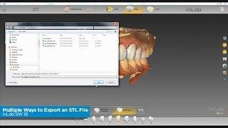 inLab SW 18: Multiple Ways to Export an STL File