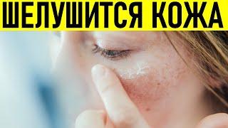 У МЕНЯ ШЕЛУШИТСЯ КОЖА | Почему шелушится кожа на лице и что с этим делать