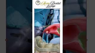 What Happens If You Swallow a Tooth  | Dental Care | Acme Dental Lounge