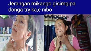 Dark sports remove home remedy # mikango gisima donggipangni method. Momin nokkrom mix tv