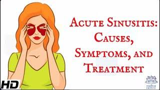 Acute sinusitis : Everything you need to know