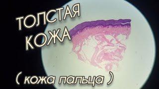 ТОЛСТАЯ #кожа