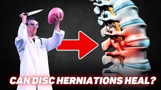 Disc Herniation Recovery Time - How Long To Heal LOW BACK PAIN & SCIATICA?