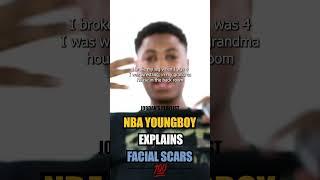 Nba Youngboy explains his FACE SCARS  #nbayoungboy #hiphop #interview #vladtv