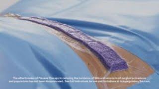 3M™ Prevena™ Therapy Tips and Tricks Video Abdominoplasty