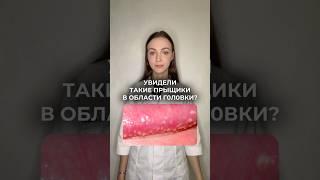 Важно понимать‼️ #медицина #доктор #здоровье #shorts