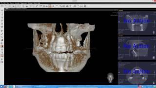 EZ3D2009 (просмотр КТ) - инструкция пользователя