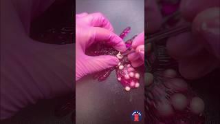 Itsy bitsy spider went to the dermatologist:) #asmr #satisfying #viral #fypシ #shorts #relax