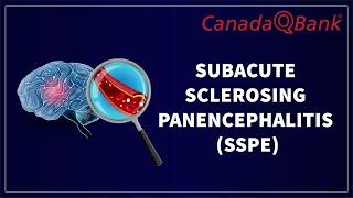 Subacute Sclerosing Panencephalitis (SSPE)