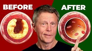 #1 BEST Meal That Cleans Arteries
