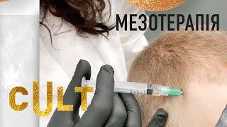 Мезотерапія Шкіри Голови | Стимуляція Росту Волосся | cUlt clinic | Київ