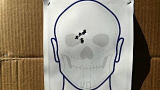 KBATs - Kit Badger Anatomy Target(s)