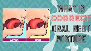 TMJ Issues? Do you know what correct oral rest posture is?