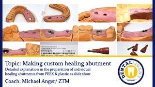 Dentaltechnik-conventionally- English Teaser -Making custom healing abutment