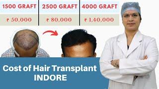 Hair Transplant Cost In Indore | Best Hair Transplant in Indore | Cost of Graft | Dr. Seema Garg