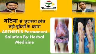 #arthiritis | Arthritis treatment | gathiya ka ilaaj unani