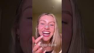 My Million Dollar Smile Routine That Costs Way Less!