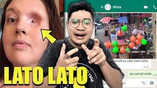 MATA ANAK INI COPOT AKIBAT KENA LATTO LATTO