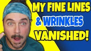 Fine Lines And Wrinkles Just Vanish In An Instant | Chris Gibson