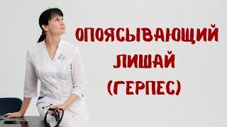 Опоясывающий лишай (герпес) Постгерпетическая невралгия Доктор Лисенкова