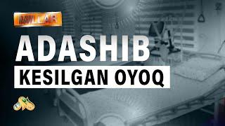 Adashib kesilgan oyoq... Millar