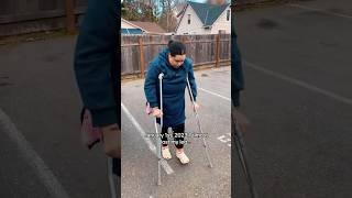 2 years ago my doctor told me I was "very lucky" I didn't lose my leg. I will never forget that.