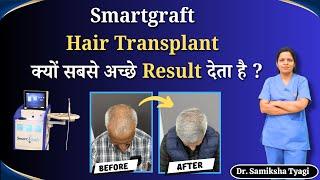 Smartgraft Hair Transplant क्यों सबसे अच्छे Result देता है ? | Advanced Hair Restoration Technology